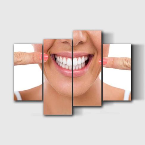 NCDIALHDFU Canvas Wall Art Woman smile Teeth whitening Dental care Photo Prints Realism Artworks Modern Wall Decor for Living Room Clinic Office Gift for Dental Students Dentist Nurses in Saudi Arabia