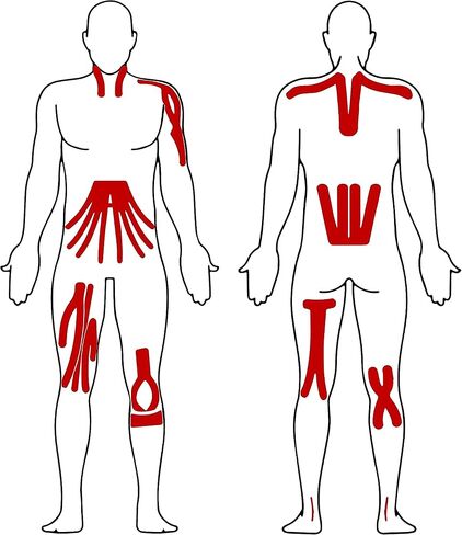 Effekt Pre Cut Kinesiology Tapes Waterproof (25 cm x 5 cm), 25 Strips - Elastic Physio Tape for Muscle Support and Injury Recovery, Medical Tape, Breathable Sports Tape (Red) in Saudi Arabia