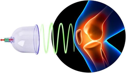 مجموعة علاج تدليك الحجامة الصينية الشفافة 12 قطعة من Restokki - الصحة التقليدية - علاج الرعاية المطبق في المنزل - سيليكون صديق للبيئة in Kuwait
