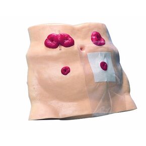 HEALTH EDCO W43027 Ostomy Care Model, 13" Length x 3" Width x 18" Height