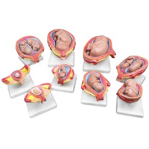 Jackson Global JS00073 Fetus Development Model | Set of 8 Models，14 Pieces in Total | Key Anatomical Features Labelled with Accompanying Key Card