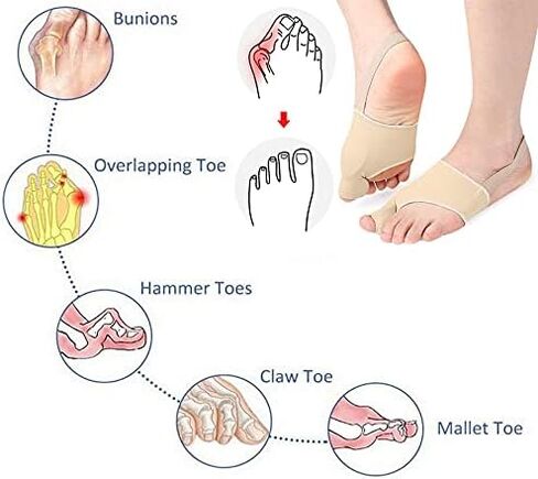 Bunion Socks Corrector for Pain Relief Hallux Valgus, Splint, Straightener Orthopedic, Separator Pad Brace Sleeve Toe Separator, Hammer Overlapping for Men and Women (S (US 4-7.5), Beige) in Saudi Arabia