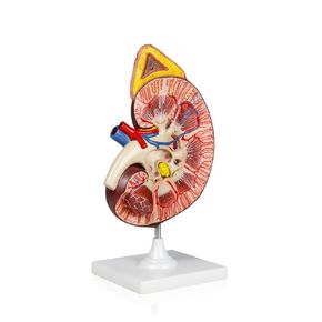 Vision Scientific VAU458 3X Kidney Model