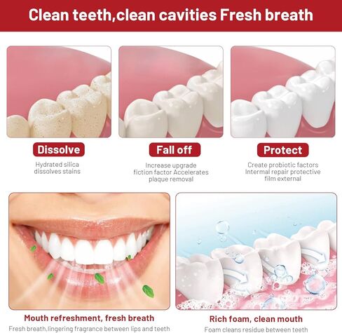 معجون أسنان بروبيوتيك SP10، معجون أسنان تبييض فائق Sp-10، معجون أسنان Sp 10، معجون أسنان بروبيوتيك لإزالة البقع Sp10، نفس منعش، معجون أسنان بروبيوتيك، معجون أسنان للعناية بالتنظيف العميق (قطعتان) in Kuwait