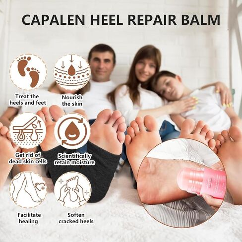 Moisturizing Socks for Cracked Heel Treatment，Heel Magic for Dry Skin or Rough Heels， with Shea Butter & Vitamin E,Lotion Silicone Toeless Socks, Comes with Heel Cream for Healthy Feet in Saudi Arabia