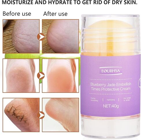 Moisturizing Socks for Cracked Heel Treatment，Heel Magic for Dry Skin or Rough Heels， with Shea Butter & Vitamin E,Lotion Silicone Toeless Socks, Comes with Heel Cream for Healthy Feet in Saudi Arabia