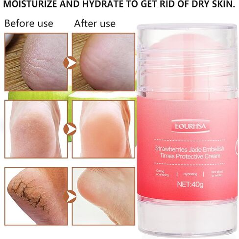 Moisturizing Socks for Cracked Heel Treatment，Heel Magic for Dry Skin or Rough Heels， with Shea Butter & Vitamin E,Lotion Silicone Toeless Socks, Comes with Heel Cream for Healthy Feet in Saudi Arabia