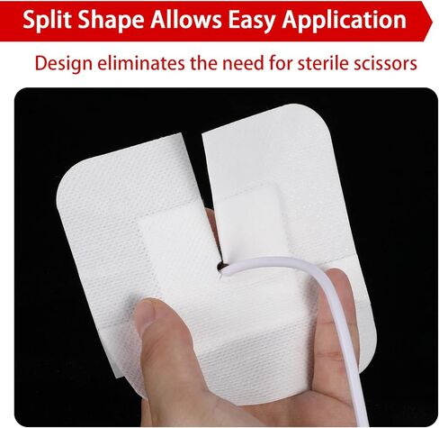 15 قطعة من ضمادات أنبوب التغذية اللاصقة المقسمة، Peg G J Supra-Pubic شق يحدها وسادة شاش، رقعة تصريف معقمة لوازم تضميد الجزيرة، حامل جهاز تثبيت القسطرة للعناية التمريضية in Kuwait