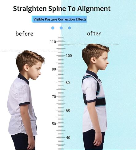 Posture Corrector For Kids - Back Brace Posture Corrector, Spine Corrector - Adjustable Upper Back Posture Brace, Prvent Children Humpback (Blue, XS) in Saudi Arabia