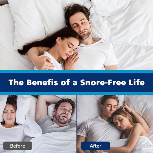 Anti Snoring Devices, Silicone Magnetic Snoring Nose Clip for Sleeping with Adjustable, Effective Sleep Apnea Devices, Snoring Solution for All Genders, Stop Snoring Aids to Ensure Deep Sleep, 8PCS in Saudi Arabia