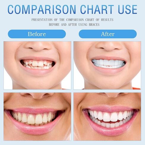 Comfortable False Teeth Temporary Teeth Set, 8set of Natural and Comfortable False Teeth for Both Women and Men, Life-Like Teeth for Male and Female, Rediscover Your Confident Grin with Eleg in Saudi Arabia