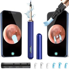 Ear Wax Removal Tool Camera, Ear Cleaner with Camera, Bebird Note5 10 Megapixel HD Otoscope with Light, Ear Camera with Tweezers 3-in-1, Earwax Removal Kit with Camera for iPhone, Android(Navy)