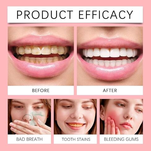 SP 10 Probiotic Toothpaste Whitening – Improve Oral Health with Dental Probiotic and Probiotic Toothpaste for a Brighter Tooth (1) in Saudi Arabia