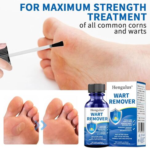 مزيل ثآليل هينجولوس بالتجميد، مزيل ثآليل أخمصي سريع المفعول للأقدام، مزيل ثآليل الساليسيليك للرجال والنساء، مزيلات الذرة لأصابع القدم- NDC Codo(s): 84010-036-01 in Kuwait