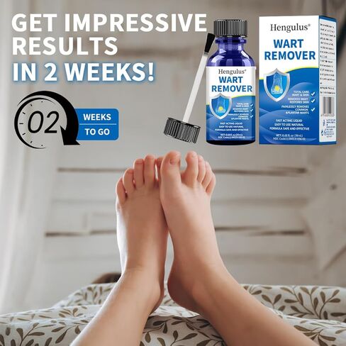 مزيل ثآليل هينجولوس بالتجميد، مزيل ثآليل أخمصي سريع المفعول للأقدام، مزيل ثآليل الساليسيليك للرجال والنساء، مزيلات الذرة لأصابع القدم- NDC Codo(s): 84010-036-01 in Kuwait