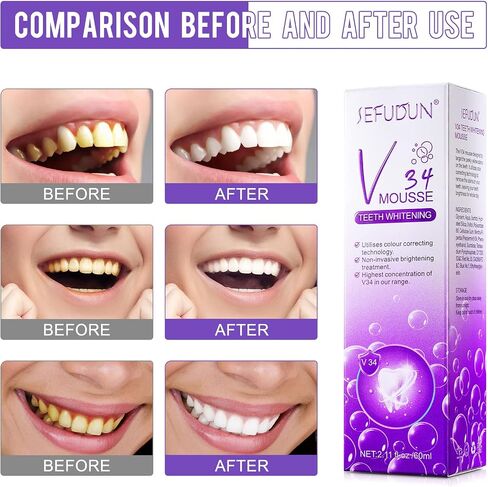 2 Pcs Purple Toothpaste for Teeth Whitening,Whitening Toothpaste for Teeth Cleaning,Purple Color Corrector Mousse for Teeth Care,Whitening Foam Toothpaste to Remove Stains in Saudi Arabia