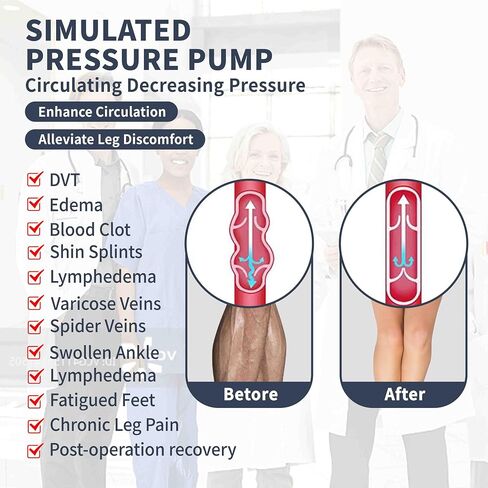 Medical Compression Thigh High Anti Embolism Stockings 15-20mmHg, for Edema, Varicose Veins, Swelling with Inspection Hole, Women & Men in Saudi Arabia