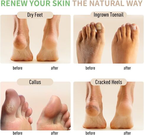 Natural Foot Soak Salt - Foot Treatment Soothes Athletes' Feet, Relieves Foot Odor and Ttchiness -9 Ounce in Saudi Arabia
