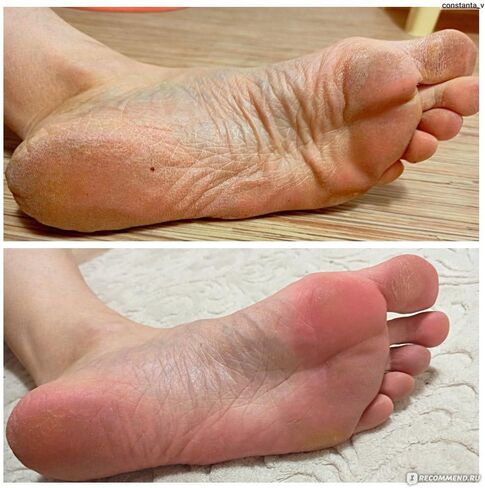 Natural Foot Soak Salt - Foot Treatment Soothes Athletes' Feet, Relieves Foot Odor and Ttchiness -9 Ounce in Saudi Arabia