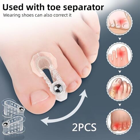 Bunion Corrector for Women & Men, KissDate Bunion Corrector for Women Big Toe, Adjustable Big Toe Straightener Toe Corrector for Treatmedy Bunion Fix Bunion Relief, Bunion Pads Cushion with Heel Strap and Silicone Pad(1 Pack) in Saudi Arabia
