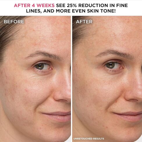 IT Cosmetics Confidence in a Cream Anti Aging Face Moisturizer – Visibly Reduces Fine Lines, Wrinkles & Signs of Aging Skin in 2 Weeks, 48HR Hydration with Hyaluronic Acid, Niacinamide in Kuwait