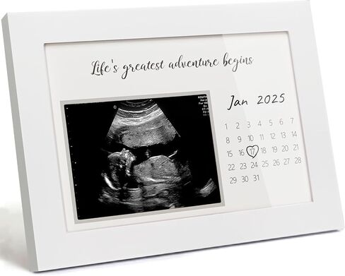 Pregnancy Announcement | Ultrasound Sonogram Picture Frame for Expecting Moms | Baby Reveal Keepsake | Ideal Baby Shower | Standard 4"x3" Frame for New Parents, Life's Greatest Adventure Begins, White in Saudi Arabia