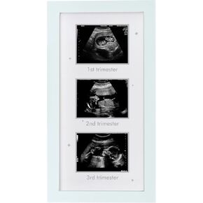 Ultrasound Picture Frame - Triple Sonogram Frame for Mom to Be | Pregnancy Photo Album Decor | Baby Nursery Essentials & Gender Reveal Gifts | First Trimester Keepsake & Pregnancy Must Haves, Black1