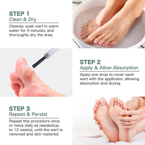 Fast Acting Liquid Wart Remover, Plantar Wart Remover, Corn Removers for Feet, Salicylic Acid Wart Removal, Corn Removers for Feet Extra Strength in Saudi Arabia