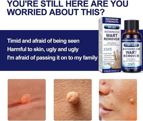 سائل مزيل الثآليل - قناع جل ذو قوة قصوى مع تركيبة حصرية لإزالة الثآليل الأخمصية والثآليل الشائعة بسرعة. آمنة وطبيعية وقوية in Kuwait