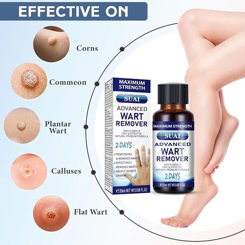 سائل مزيل الثآليل - قناع جل ذو قوة قصوى مع تركيبة حصرية لإزالة الثآليل الأخمصية والثآليل الشائعة بسرعة. آمنة وطبيعية وقوية in Kuwait