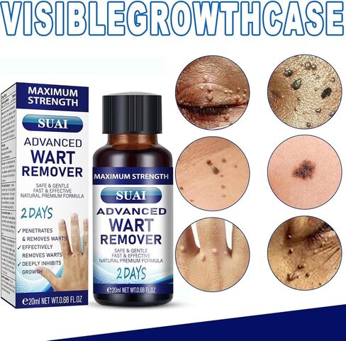 سائل مزيل الثآليل - قناع جل ذو قوة قصوى مع تركيبة حصرية لإزالة الثآليل الأخمصية والثآليل الشائعة بسرعة. آمنة وطبيعية وقوية in Kuwait