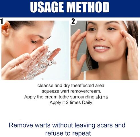 سائل مزيل الثآليل - قناع جل ذو قوة قصوى مع تركيبة حصرية لإزالة الثآليل الأخمصية والثآليل الشائعة بسرعة. آمنة وطبيعية وقوية in Kuwait