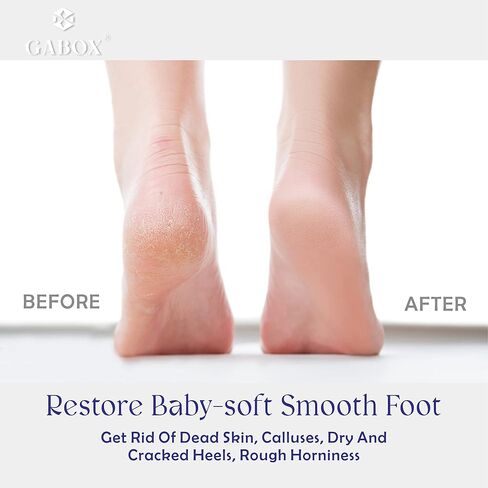 GABOX Nano Glass Pro Foot File - Callus Remover for Feet - Heel Foot Scrubber Dead Skin Exfoliator - Pedicure SPA Tool for Women & Men - Removedor de Callos en Los Pies - Crystal Purple in Kuwait
