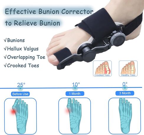 Bunion Corrector for Women and Men Big Toe,Upgraded Press-Button Bunions Correction,Toe Straightener with Bunion Relief,Suitable for Left and Right Feet, Medium,Black in Saudi Arabia