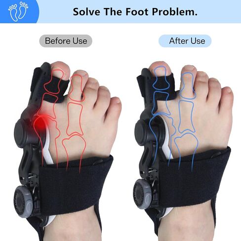 Bunion Corrector for Women and Men Big Toe,Upgraded Press-Button Bunions Correction,Toe Straightener with Bunion Relief,Suitable for Left and Right Feet, Medium,Black in Saudi Arabia