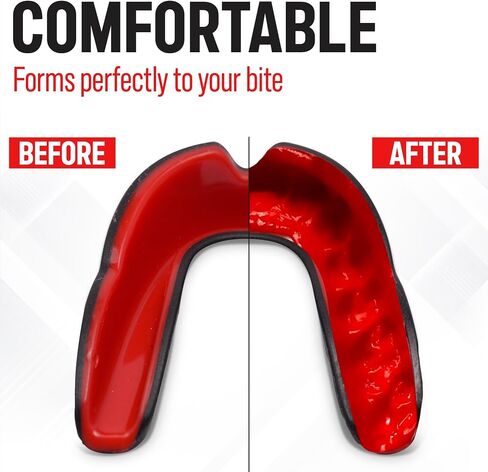 Sports Mouth Guard for Boxing, MMA, UFC, Muay Thai, Football, Lacrosse and Hockey - Men and Women Mouthguard for Adults, Youth and Kids with a Protective Breathable Case (Basil) in Kuwait