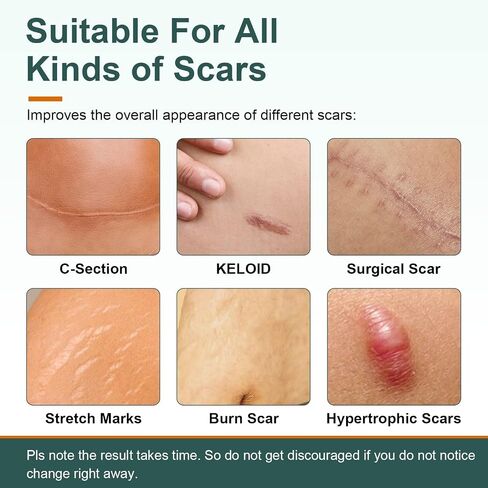 Silicone Scar Sheets, Tape, Strips 120" x 1.5" Roll-Heal Keloid, C-Section and Tummy Tuck - As Surgical Cream, Gel, Patch, Bandage in Saudi Arabia