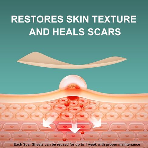Silicone Scar Sheets, Tape, Strips 120" x 1.5" Roll-Heal Keloid, C-Section and Tummy Tuck - As Surgical Cream, Gel, Patch, Bandage in Saudi Arabia