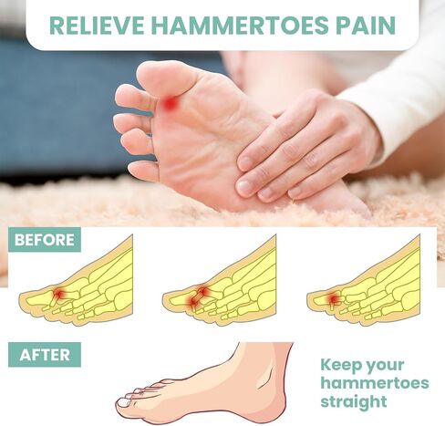 Welnove Hammer Toe Corrector and Straightener - 8 Pcs Toe Support Pads Cushion - Realign Bent, Crooked, Curled, Claw, Hammer Toes - Three Loops Design in Saudi Arabia