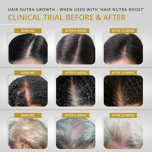 VITAMINS REVIVE Hair Supplement Hair Growth Vitamins for Women - USA Clinically Tested - Hair Loss Products for Thinning & Thickening - Female Hair Regrowth Treatment (1 Month Supply) in Saudi Arabia