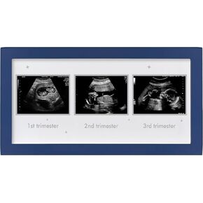 Ultrasound Picture Frame - Triple Sonogram Frame for Mom to Be | Pregnancy Photo Album Decor | Baby Nursery Essentials & Gender Reveal Gifts | First Trimester Keepsake & Pregnancy Must Haves - Blue1
