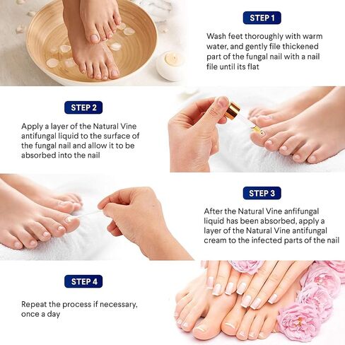Toenail Fungus Treatment for Toenail and Fingernails: Fungus Nail Treatment Liquid 15ML and Antifungal Nail Repair Cream 20G - Nail Fungus Treatment Extra Strength - Plant Extract Ingredients in Saudi Arabia