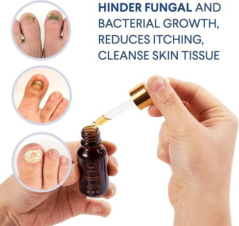 Toenail Fungus Treatment for Toenail and Fingernails: Fungus Nail Treatment Liquid 15ML and Antifungal Nail Repair Cream 20G - Nail Fungus Treatment Extra Strength - Plant Extract Ingredients in Saudi Arabia