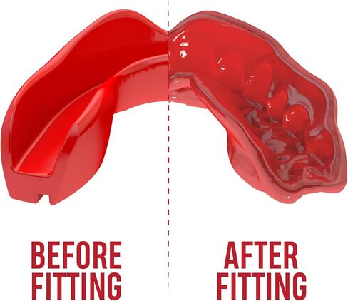 SAFEJAWZ Sports Mouthguard Slim Fit, Adult and Junior Mouth Guard with Case for Boxing, Basketball, Lacrosse, Football, MMA, Martial Arts, Hockey and All Contact Sports (Adult 12+ Years, Clear) in Kuwait