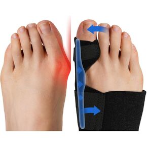 Fittest Pro Bunion Corrector (2pcs) FSA or HSA Eligible, Orthopedic Bunion Splint, Big Toe Separator Pain Relief, Non-Surgical Hallux Valgus Correction, Hammer Toe Straightener, Day Night Support