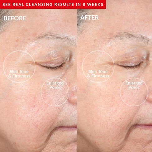 PMD Clean Redvolution - Smart Facial Cleansing Device with Silicone Brush & Age-Defying Red Light Therapy Treatment - Smooths Fine Lines and Wrinkles, Firms and Tones - For Face & Body in Saudi Arabia