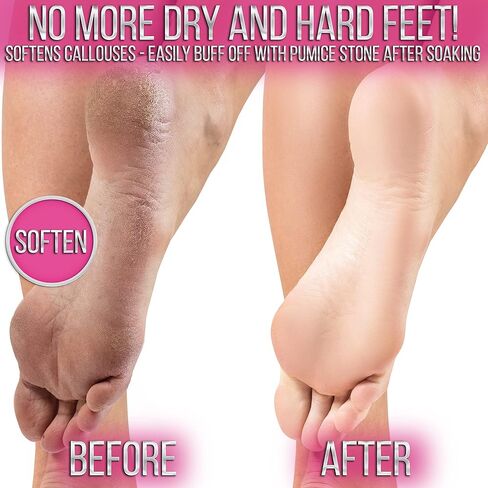 SOO Jelly Pedicure Packs - Pedicure Foot Soak For Dry Feet - Moisturizing Jelly Spa Pedi Soak - Foot Spa Bath Soak Salts For Soaking -Gel To Relax Sore Feet (Arabian Jasmine) in Saudi Arabia
