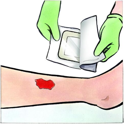 Medline Dressing Stratasorb Comp Island, 10 Count in Saudi Arabia