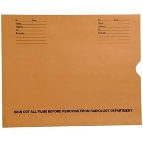 Negative Preserver Envelope | 14-½" x 17-½" | Box of 500 | Heavy Duty Preprinted X-Ray Jacket | Offset Thumb Cut | Ideal for Radiology Departments and Medical Offices