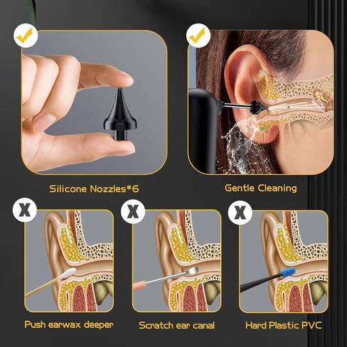 Ear Wax Removal Tool, Ear Cleaner with 1296P FHD Camera, Ear Cleaning Kit with Lights, Compatible with iPhone, iPad, and Android(White) in Saudi Arabia